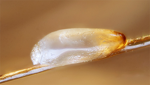 Lice nits are protected by a special shell, so even many modern means are not able to kill them.