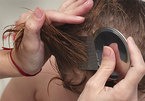 After treatment of the head with a spray, lice and nits should be carefully combed out with a comb.