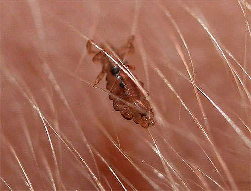 Combing a child's lice with a comb is not only effective, but also beneficial for the hair.