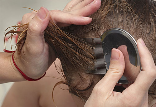 Combing lice and nits with a comb is not an easy but effective procedure.