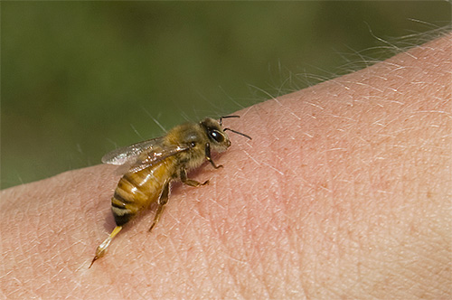 Both bee venom and hornet venom are highly allergenic.