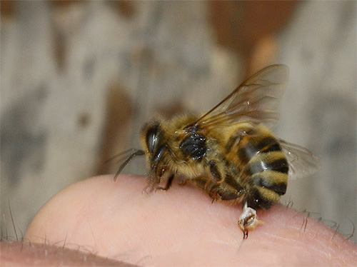 Unlike the hornet, a bee leaves its sting in the human body during a bite and dooms itself to death.