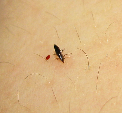 Flea bites can cause some infectious diseases.