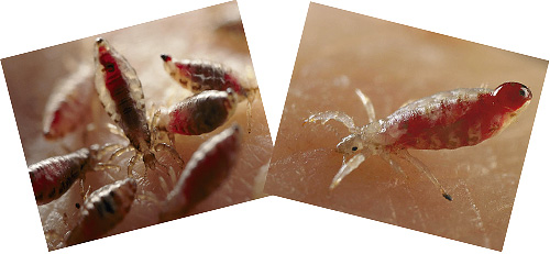 Let's talk about how lice bites look, and also about their potential danger to humans ...