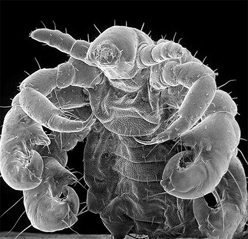 And this is a photo of a louse under an electron microscope.