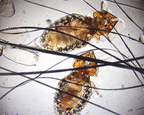 Cat lice under the microscope