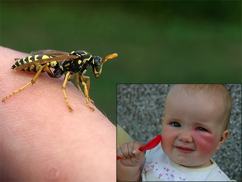 Let's talk about what should be the actions of parents in case a child was bitten by a wasp, and see what should be done in this situation in the first place ...