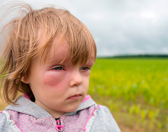 When providing first aid to a child, it should be remembered that many allergy medications are not intended for use in children.