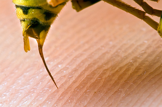 The photo shows the sting of a wasp - an insect can use it several times in one attack.