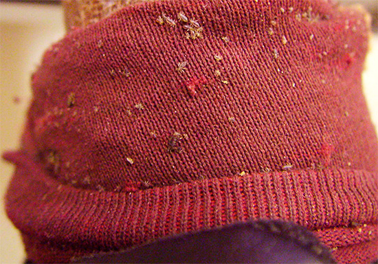 Linen lice can bite any part of the body, and are not tied to a person's hair.