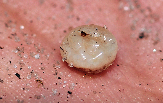 This is what a sand flea female extracted from under the skin, puffed up by eggs that ripen in it.