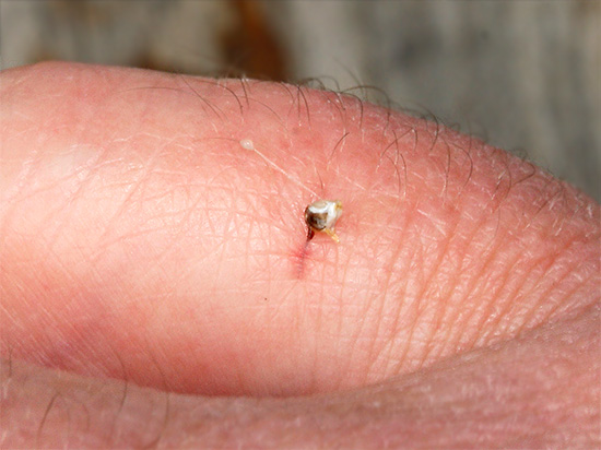 Om ett sting sticker ut efter en insektsbit i såret, var det en bie.