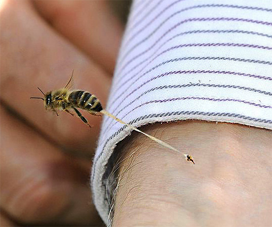 Bee-stinget förblir vanligtvis i offrets hud och kommer ut med en del av insekternas inre organ.