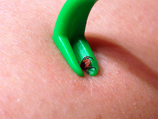 Often, when trying to remove a tick, his head comes off and remains in the skin.