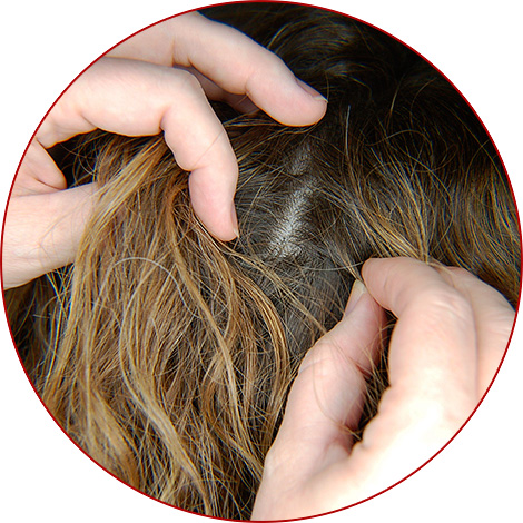 Today, it is possible to get rid of lice and nits in the hair quickly enough, in just 1 day - then we will talk further about this ...