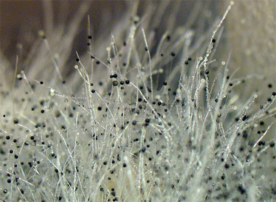 Black mold under a microscope - the abundance of its airborne spores can be a serious danger to human health.
