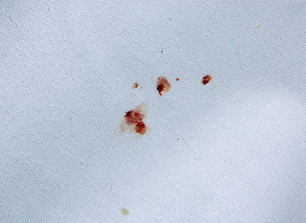 And here is another example of blood stains on bed infested with bedbugs.