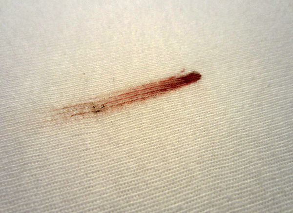 After the feast of night bloodsuckers, small blood stains often remain in the bed.