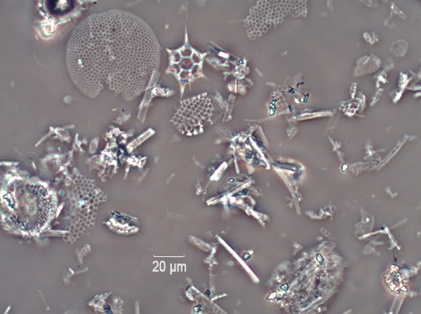 Bilden visar partiklar av diatomit under ett mikroskop.