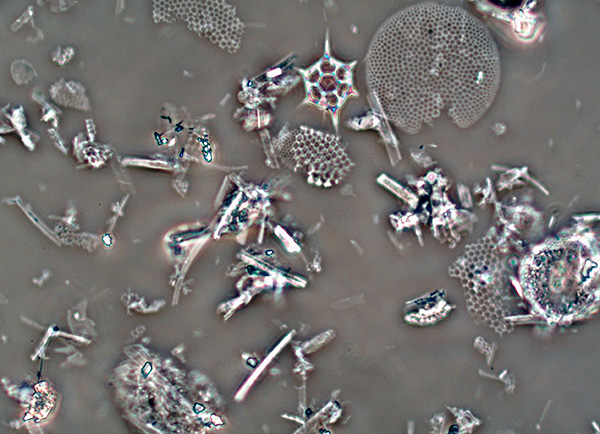 Diatomitové částice pod mikroskopem.