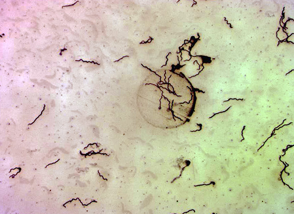 Borrelia burgdorferi pod mikroskopem (při 400x zvětšení).