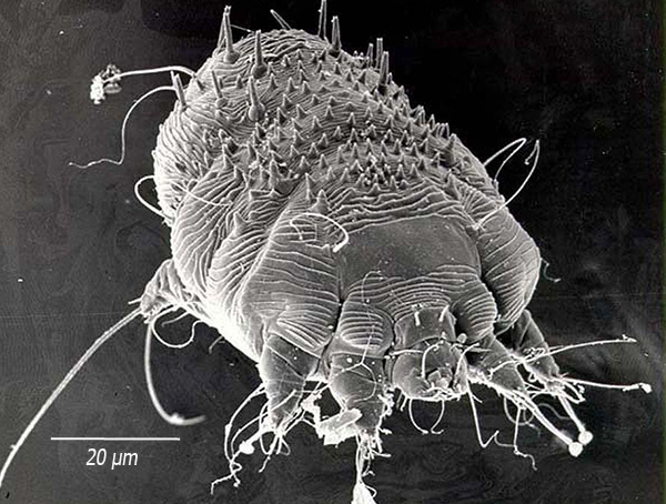 Tento parazit žije v tloušťce kůže, dělá pohyby a krmení na epidermis.