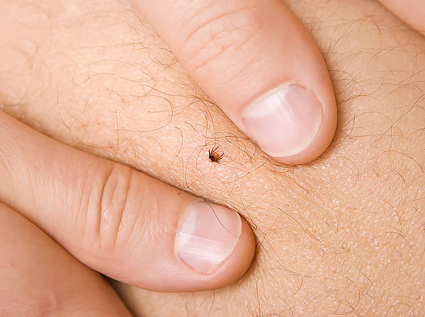 It is very difficult to grasp such a small tick with the fingers, especially if the nails are short-cropped.