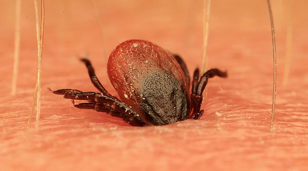 Food is the most important process in the life of a tick, and therefore no danger can force it to unstuck itself from the skin and leave the host's body.
