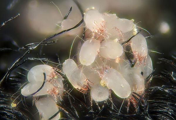 With the naked eye to notice dust mites Dermatophagoides pteronyssinus in the carpet is almost impossible, because of what most people believe that they are in the house and not.