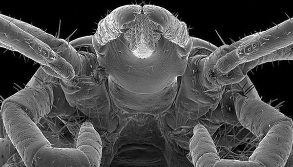It looks like the head of ixodic tick at high magnification.
