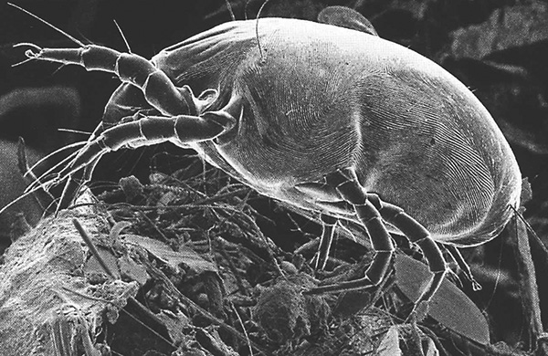 Dermatophagoides pteronyssinus (photo taken using a scanning electron microscope).