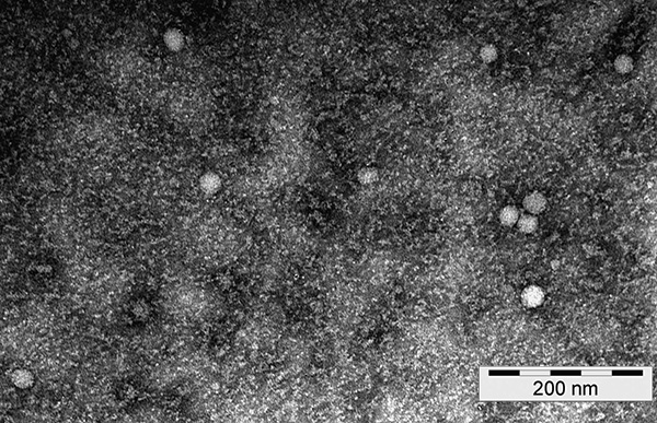 Så här ser tjurburen encefalitviruspartiklar ut under ett elektronmikroskop.