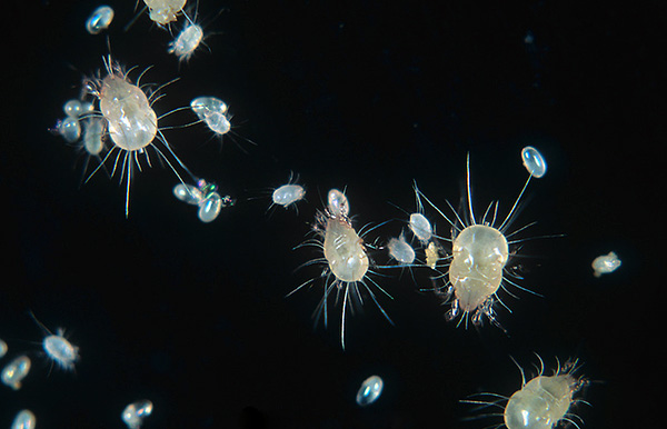 In the picture, dust mite eggs are clearly visible.