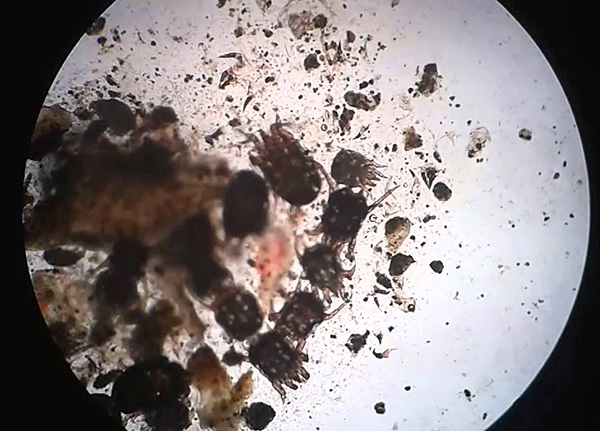 Ear mites in a sample of animal ear discharges.