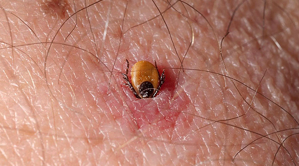 Let's see what needs to be done if a tick bitten a person ...